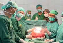 Tim Dokter RSUD dr Fauziah Bireuen Berhasil Angkat Tumor 15 Kg dari Wanita Lansia Asal Bener Meriah
