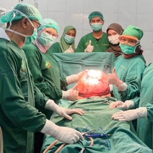 Tim Dokter RSUD dr Fauziah Bireuen Berhasil Angkat Tumor 15 Kg dari Wanita Lansia Asal Bener Meriah