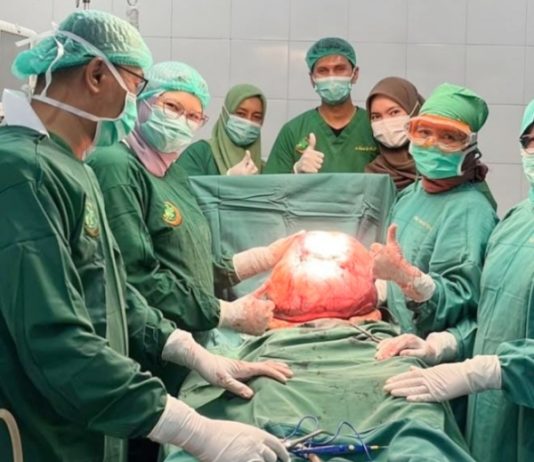 Tim Dokter RSUD dr Fauziah Bireuen Berhasil Angkat Tumor 15 Kg dari Wanita Lansia Asal Bener Meriah